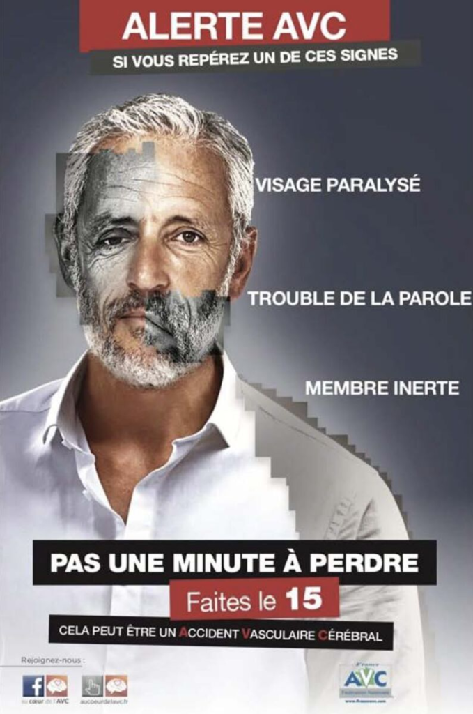 Alerte AVC
