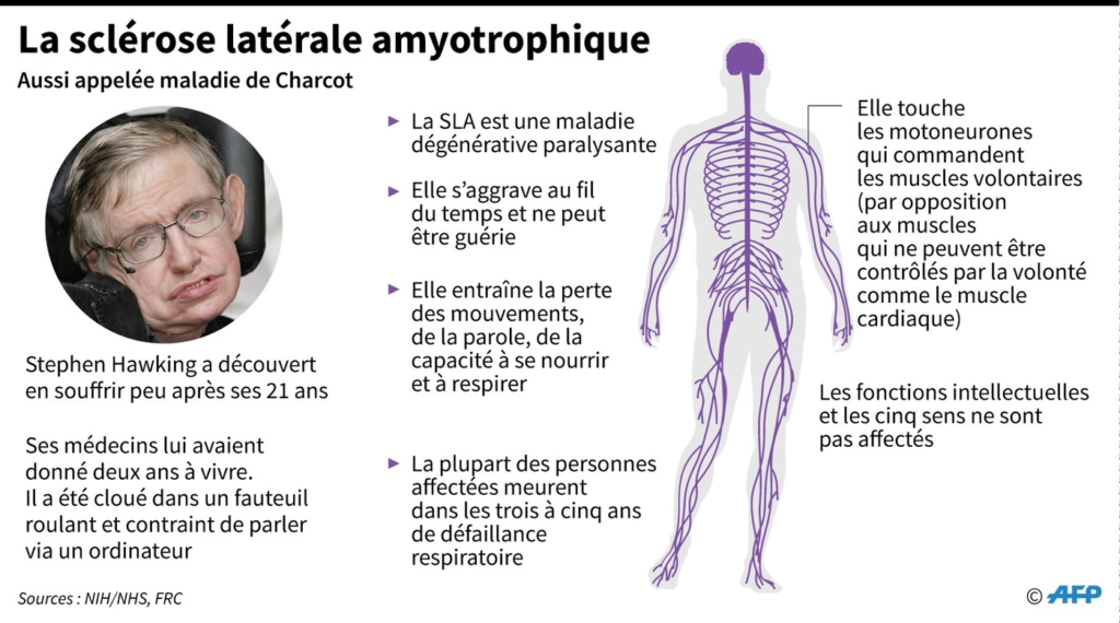 Description de la maladie de Charcot